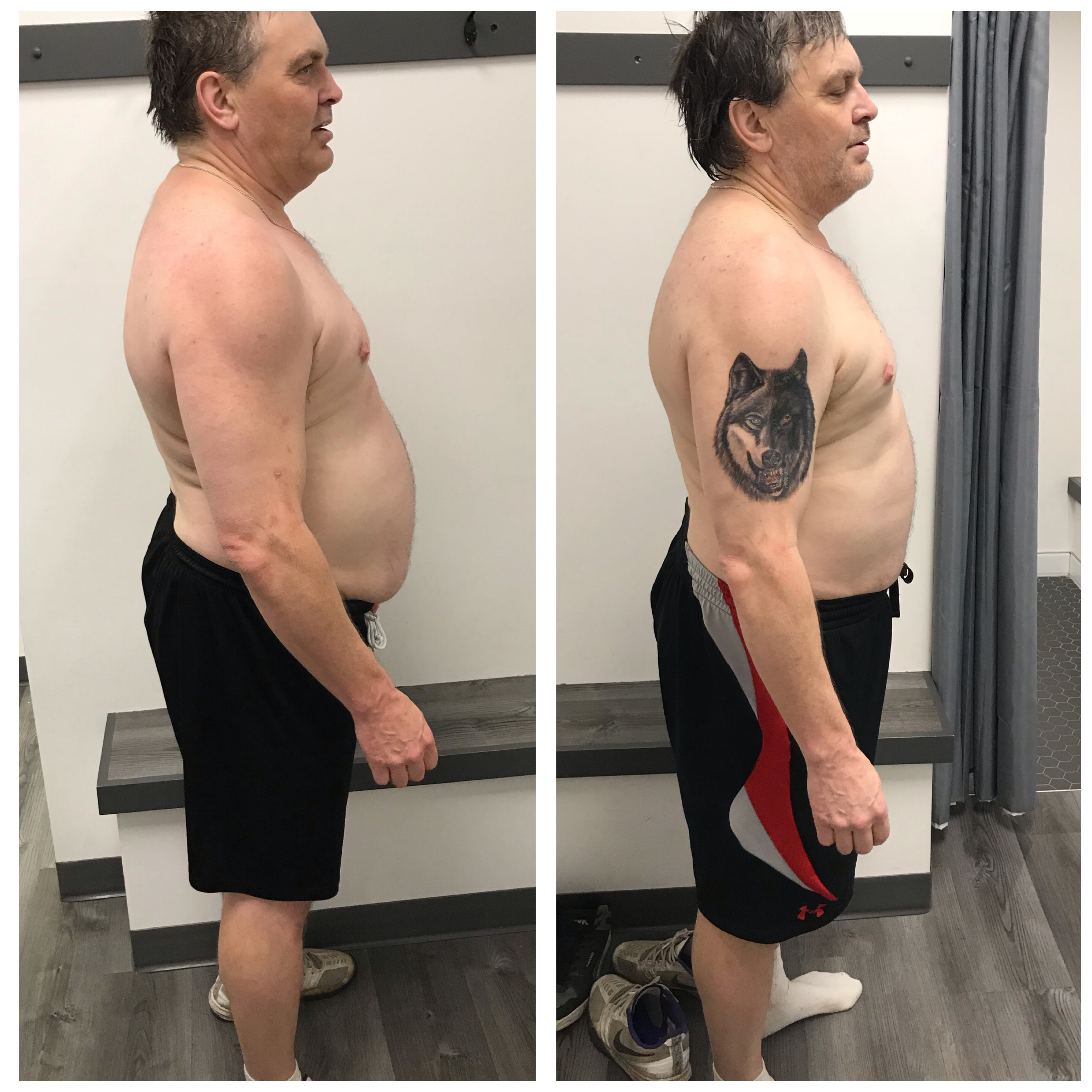 Craig transformation